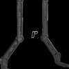 79652 Universal soundbar mount, up to 15 kg, for TVs up to 49