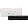 Ipiece-Computer N3X1D Laptop Battery 11.1V 5800mAh Samsung/LG Cells